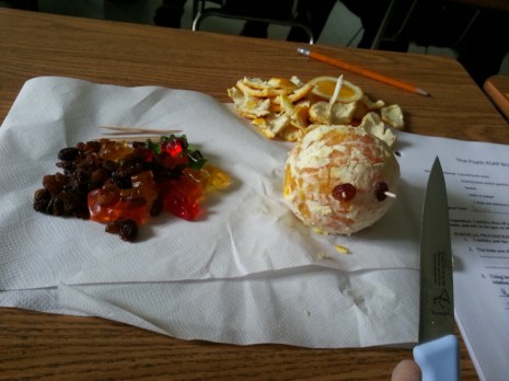 When we ran out of scalpels we scooped up the paring knives from the staff room kitchen!